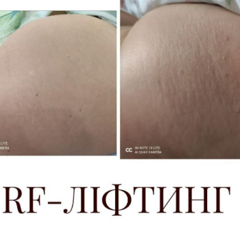 Фото с портфолио Людмила Азарова