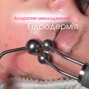 Фото с портфолио Шалена Краса
