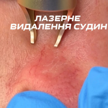 Фото с портфолио Luna Laser