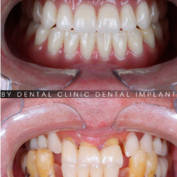Фото с портфолио Ruby Dental Clinic