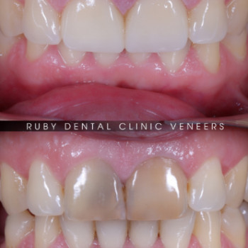 Фото с портфолио Ruby Dental Clinic