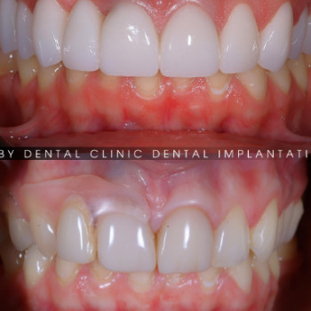 Фото с портфолио Ruby Dental Clinic
