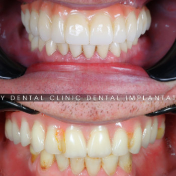 Фото с портфолио Ruby Dental Clinic