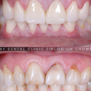 Фото с портфолио Ruby Dental Clinic