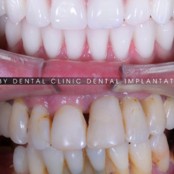 Фото с портфолио Ruby Dental Clinic