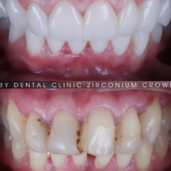 Фото с портфолио Ruby Dental Clinic