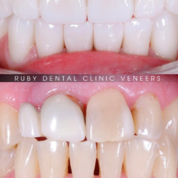 Фото с портфолио Ruby Dental Clinic