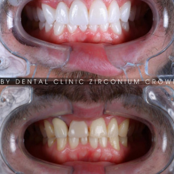 Фото с портфолио Ruby Dental Clinic