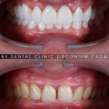 Фото с портфолио Ruby Dental Clinic