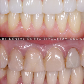 Фото с портфолио Ruby Dental Clinic