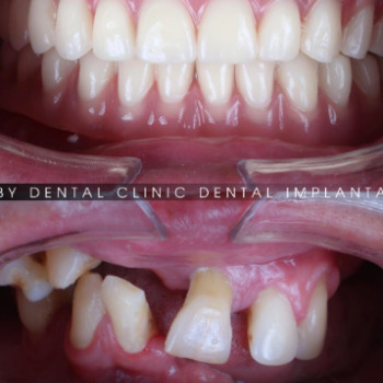 Фото с портфолио Ruby Dental Clinic