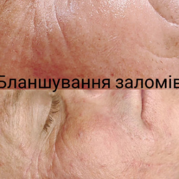 Фото с портфолио Наталия Мартыненко