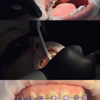 Фото с портфолио Antipa Dentistry