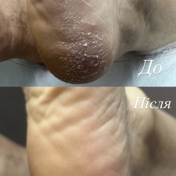 Фото с портфолио Ірина Груба