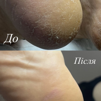 Фото с портфолио Ірина Груба