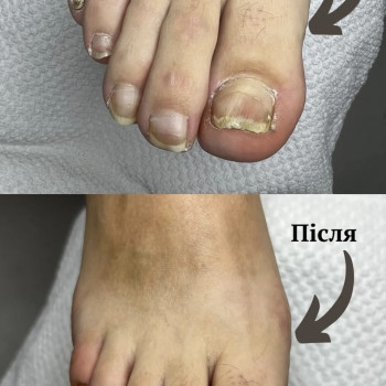 Фото с портфолио Ірина Груба