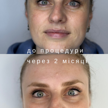 Фото с портфолио Laser Impulse