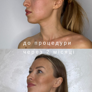 Фото с портфолио Laser Impulse