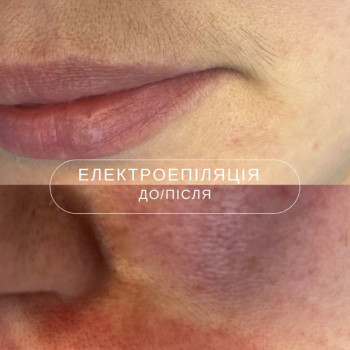 Фото с портфолио Laser impulse