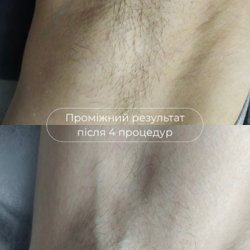Фото с портфолио Laser impulse