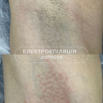 Фото с портфолио Laser impulse