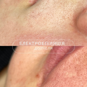 Фото с портфолио Laser impulse