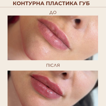 Фото с портфолио Лина Гетьман