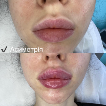 Фото с портфолио Лина Гетьман