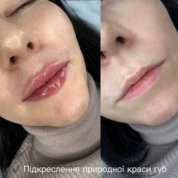 Фото с портфолио Лина Гетьман