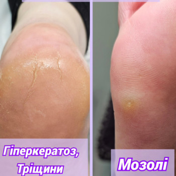 Фото с портфолио Виктория Карпенко