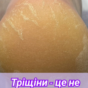 Фото с портфолио Виктория Карпенко