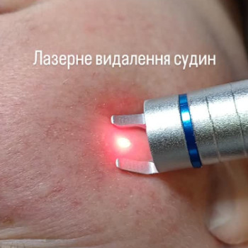 Фото с портфолио Инга Мовчанюк