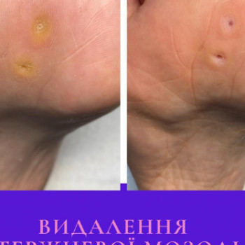 Фото с портфолио Лілія Гуц