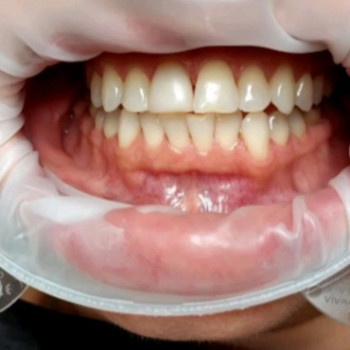 Фото с портфолио Nazaria Dental