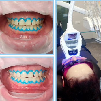 Фото с портфолио Nazaria Dental