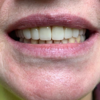 Фото с портфолио Nazaria Dental