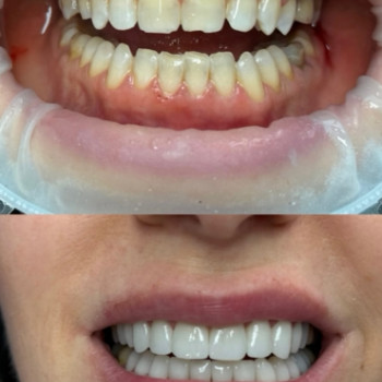 Фото с портфолио Nazaria Dental