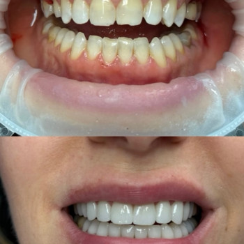 Фото с портфолио Nazaria Dental