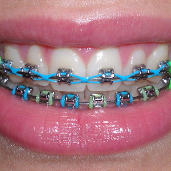 Фото с портфолио Nazaria Dental