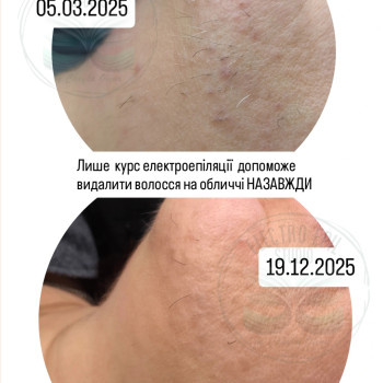 Фото с портфолио Олена Чайка