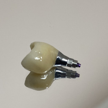 Фото с портфолио T-dent