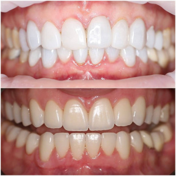 Фото с портфолио Dental Home