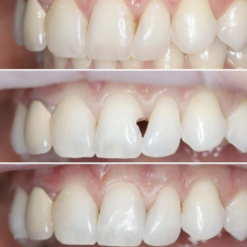 Фото с портфолио Dental Home