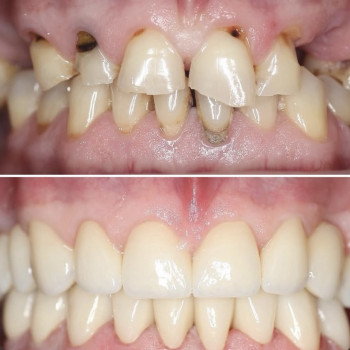 Фото с портфолио Dental Home