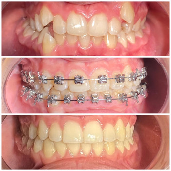 Фото с портфолио Prytula Dental Studio
