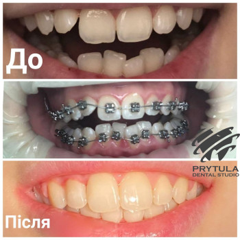 Фото с портфолио Prytula Dental Studio