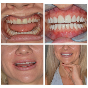 Фото с портфолио Prytula Dental Studio