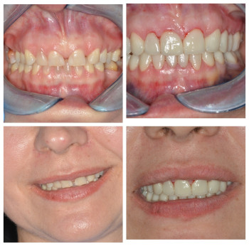 Фото с портфолио Prytula Dental Studio