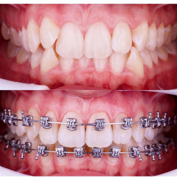 Фото с портфолио Prytula Dental Studio
