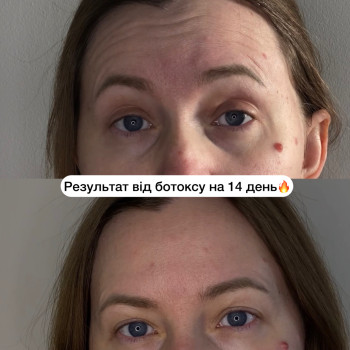 Фото с портфолио Анна Краслянська